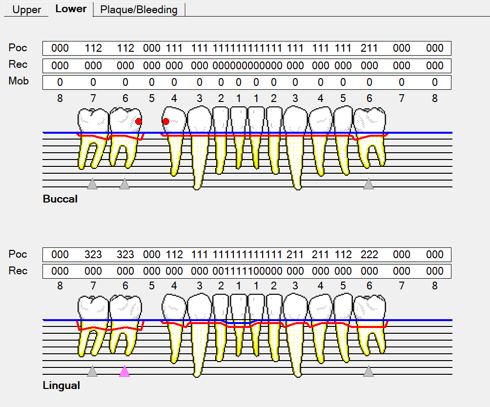Original Perio Charting EXACT Help Centre