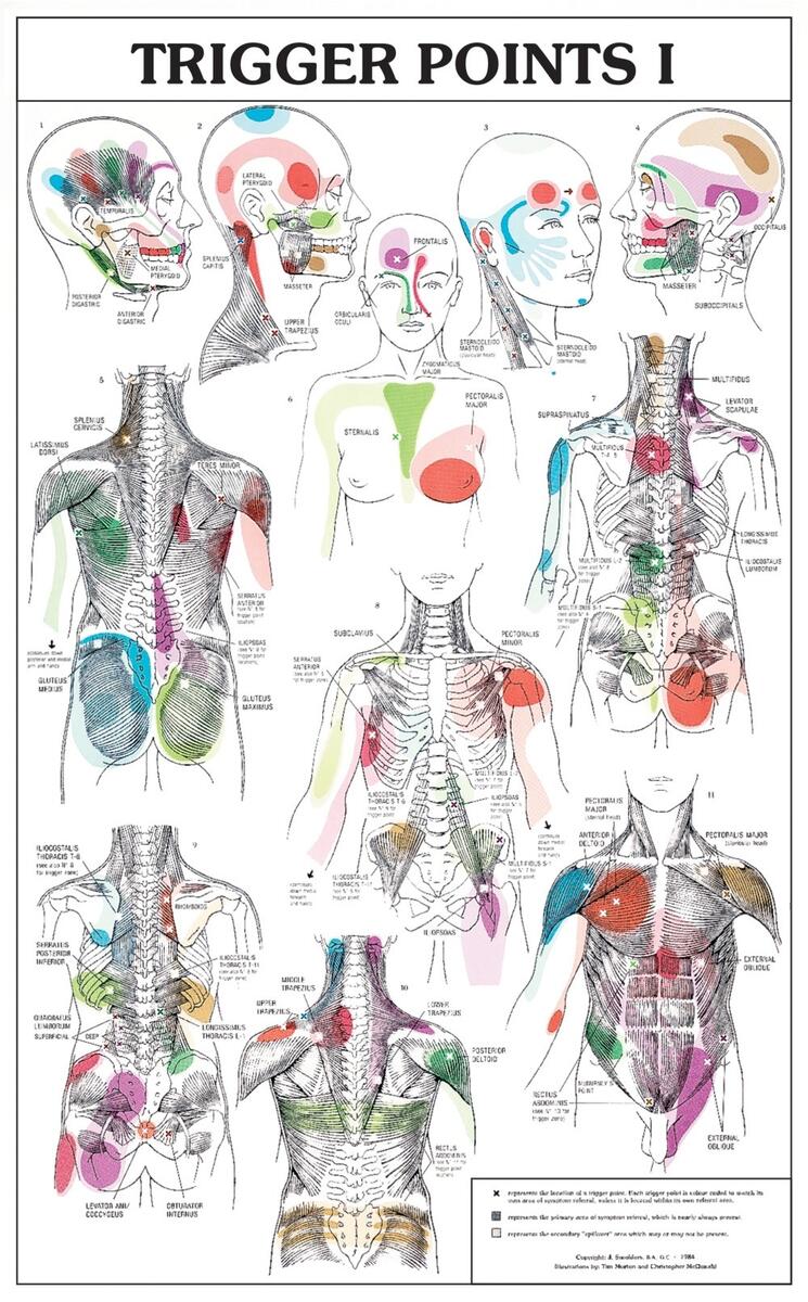 Point Magazine Trigger Points Anatomical Diagram Chart Premium Anatomy Poster Print Where Are Trigger Points Located